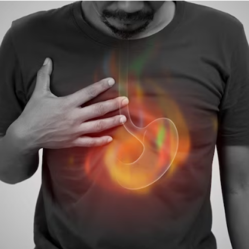 Descubre los síntomas silenciosos de la gastritis