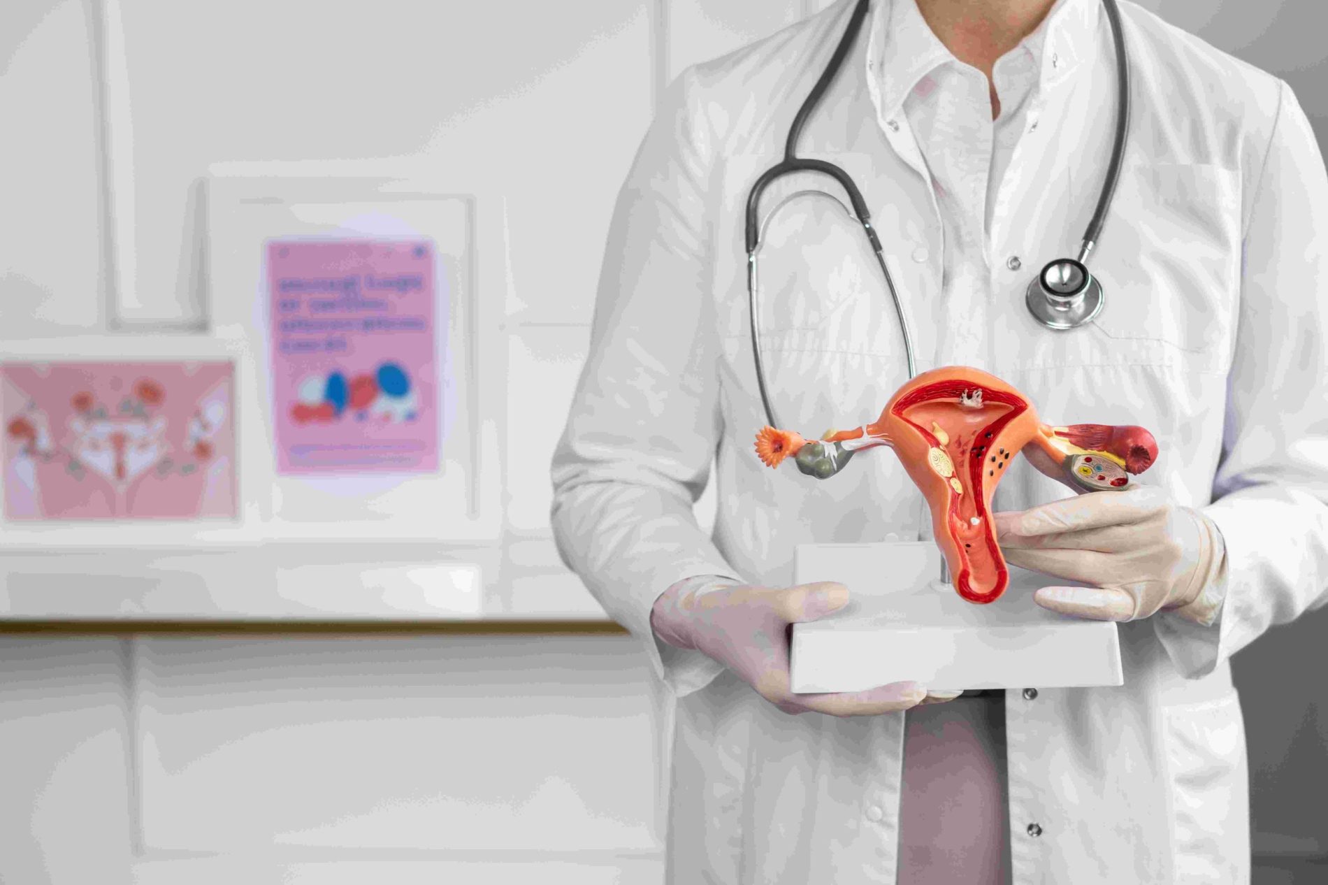 El diagnóstico tardío de endometriosis, un problema de salud pública en aumento