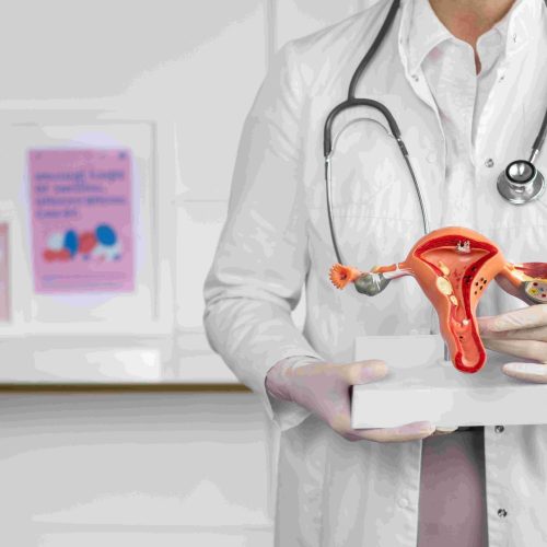 El diagnóstico tardío de endometriosis, un problema de salud pública en aumento