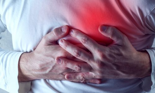 Cómo prevenir un infarto