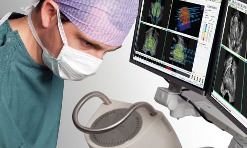 El Instituto Nacional de Cancerología (INC)  implementa por primera vez en Colombia braquiterapia de próstata en tiempo real